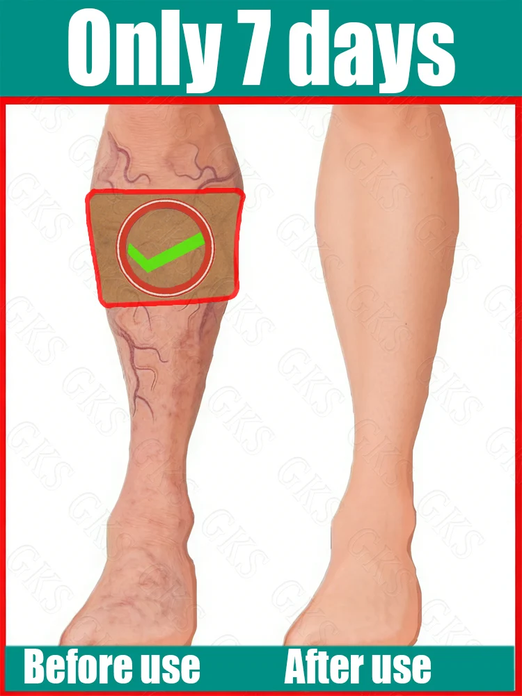 Foot Care Patches for Leg Tension Relief And Comfortable Walking - Soothing Foot Patches for Easy Foot Care