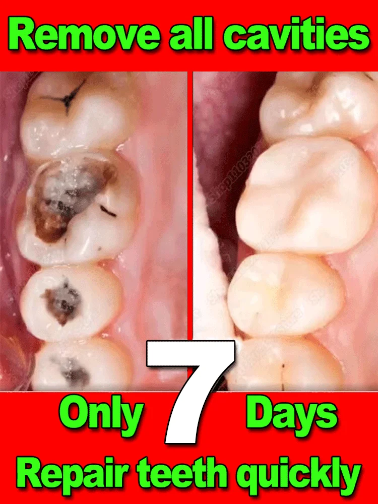 Repair cavities, Prevent tooth decay,remove plaque, toothache, whiten teeth, relieve periodontitis, freshen up bad breath