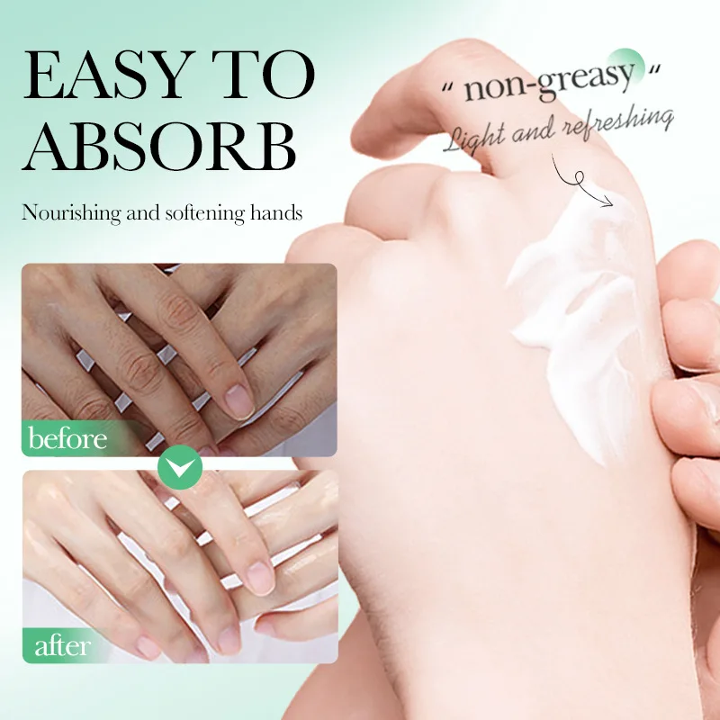 كريم ترطيب لليدين بالنياسيناميد - يحافظ على يديك ناعمة وناعمة وناعمة بشكل جيد - مرطب #4