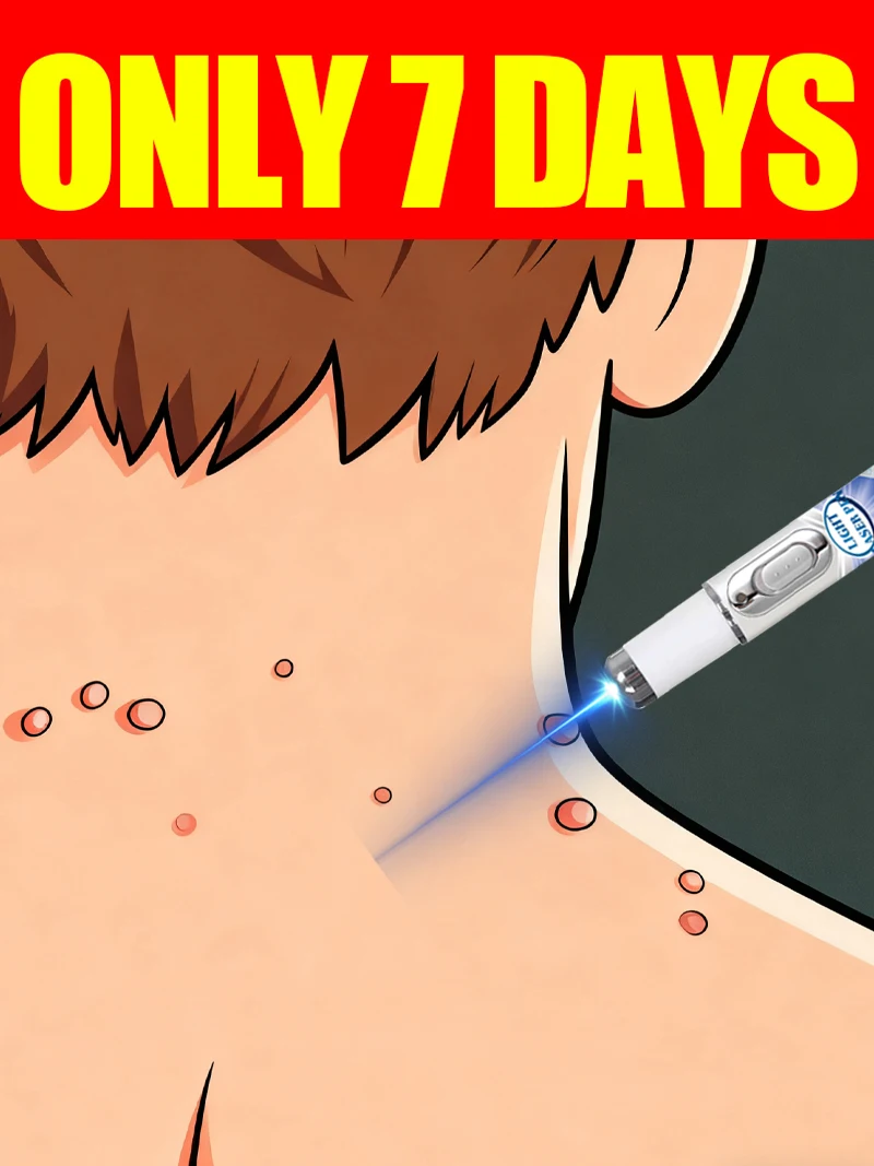 3세대 레이저는 7일 만에 사마귀와 작별을 이합니다