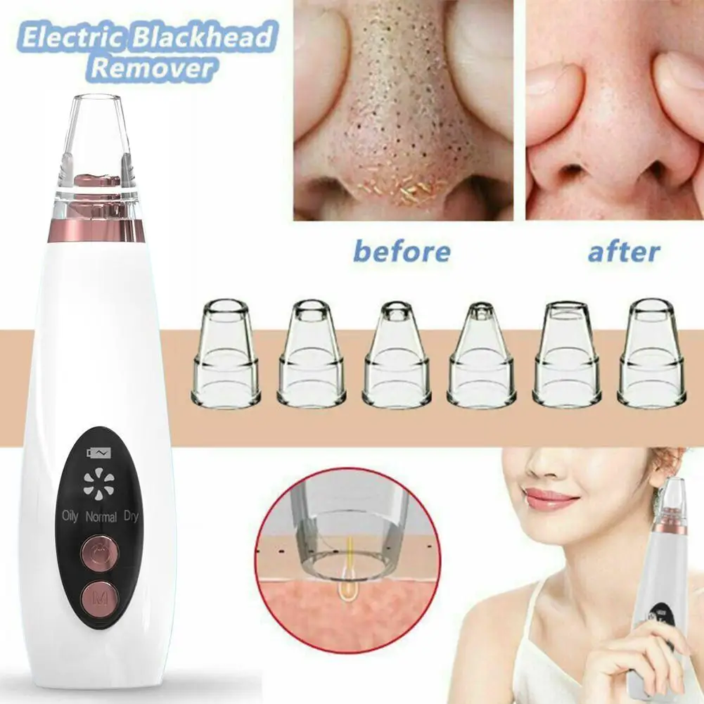 Highly Efficient Electric Blackhead Remover USB Rechargeable Three Speed Adjustable Suction Levels Different Skin Types