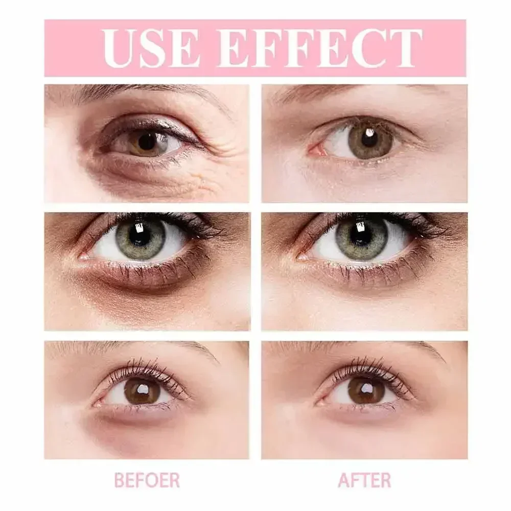 Remove Dark Circles Eye Cream Anti-Wrinkle Fade Fine Lines Anti Eye Bags Puffiness Lift Firming Moisturizing Brighten Eye Care