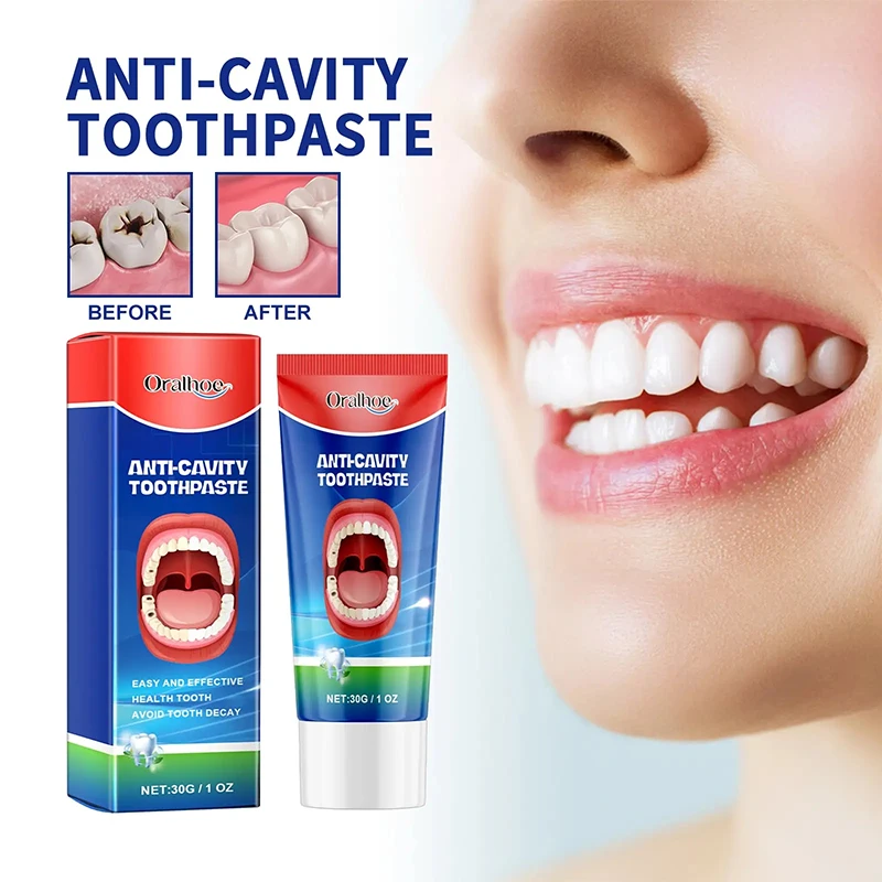 New Teeth Whitening Toothpaste Removing Dental Calculus Protect Teeth Freshens Breath Anti-cavity Tooth Relieve Periodontitis