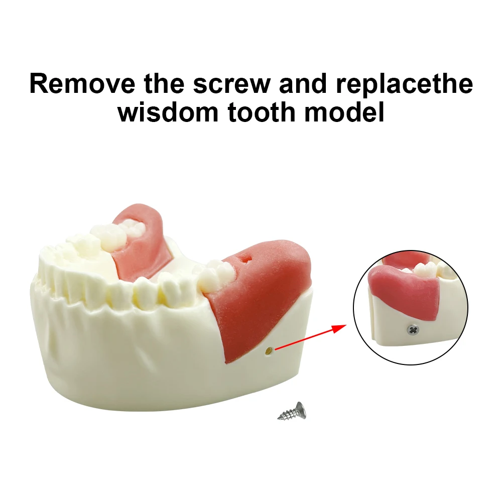 Dental Impacted Tooth Model Unerupted Tooth Extraction Practice Training Model Resin Materials Wisdom Tooth Teaching Study Model