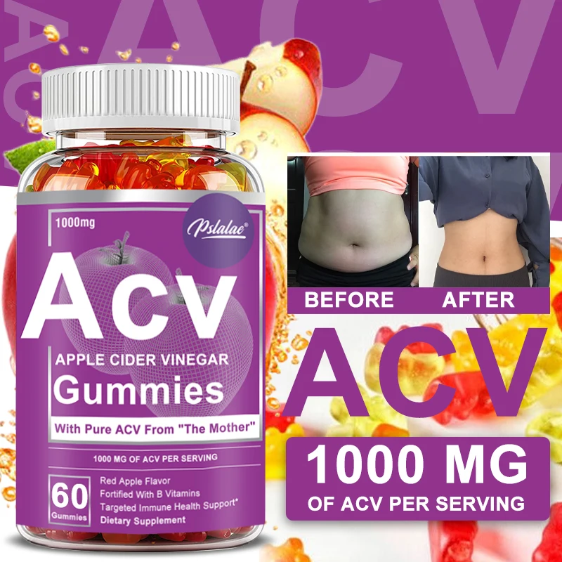 Apple Cider Vinegar Gummies - Improves Digestion, Energy, Appetite Suppression,Weight Management, Fat Burner