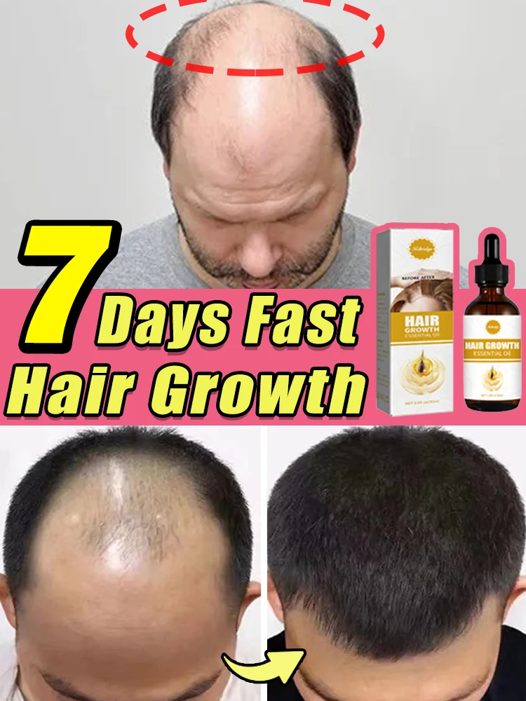 

Fast Hair Regrowth Essence, Repair Dryness, Increase Hair Volume, Nourish Damaged Hair, Scalp Treatment Oil