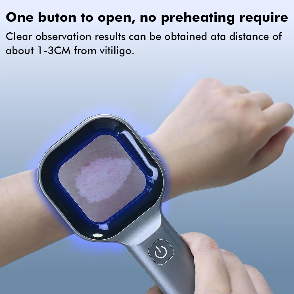 Lámpara de madera analizador de piel vitíligo Detector de psoriasis luz LED dispositivo de diagnóstico de piel Facial lámpara luz UV detección de aumento