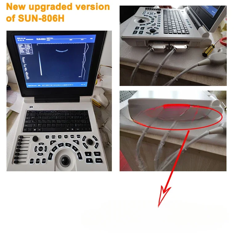 Portable Pig Cow Cattle Horse Veterinary pregnancy Ultrasound Scanner Machine SUN-806H