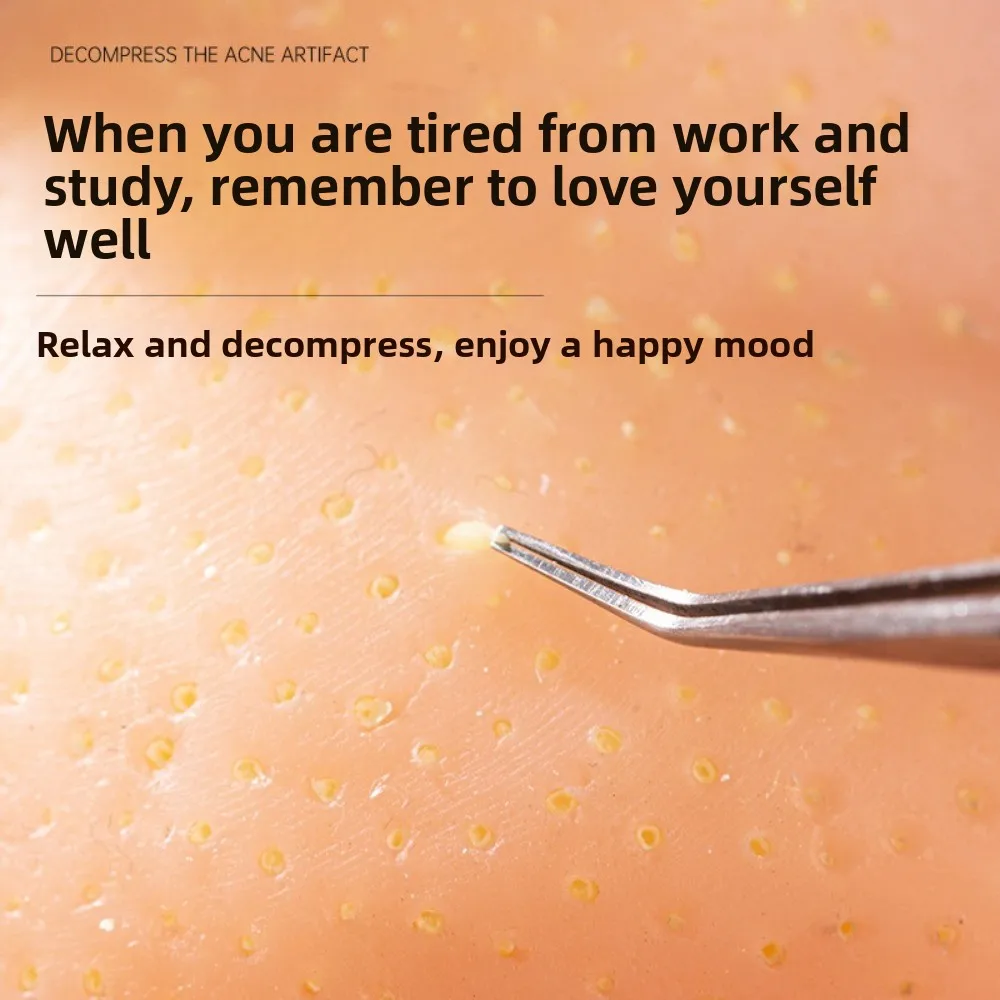 Alivio del estrés, recargable, espinillas, descompresión sensorial, cabeza grande, apretar, Pus realista, Pus Burst Fidget