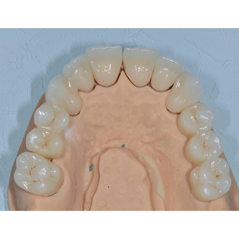 Blocos de zircônia st 95*10/12/14/16/18/20/22/25mm para sistema cadcam aberto porcelana dentes falsos laboratório dentário