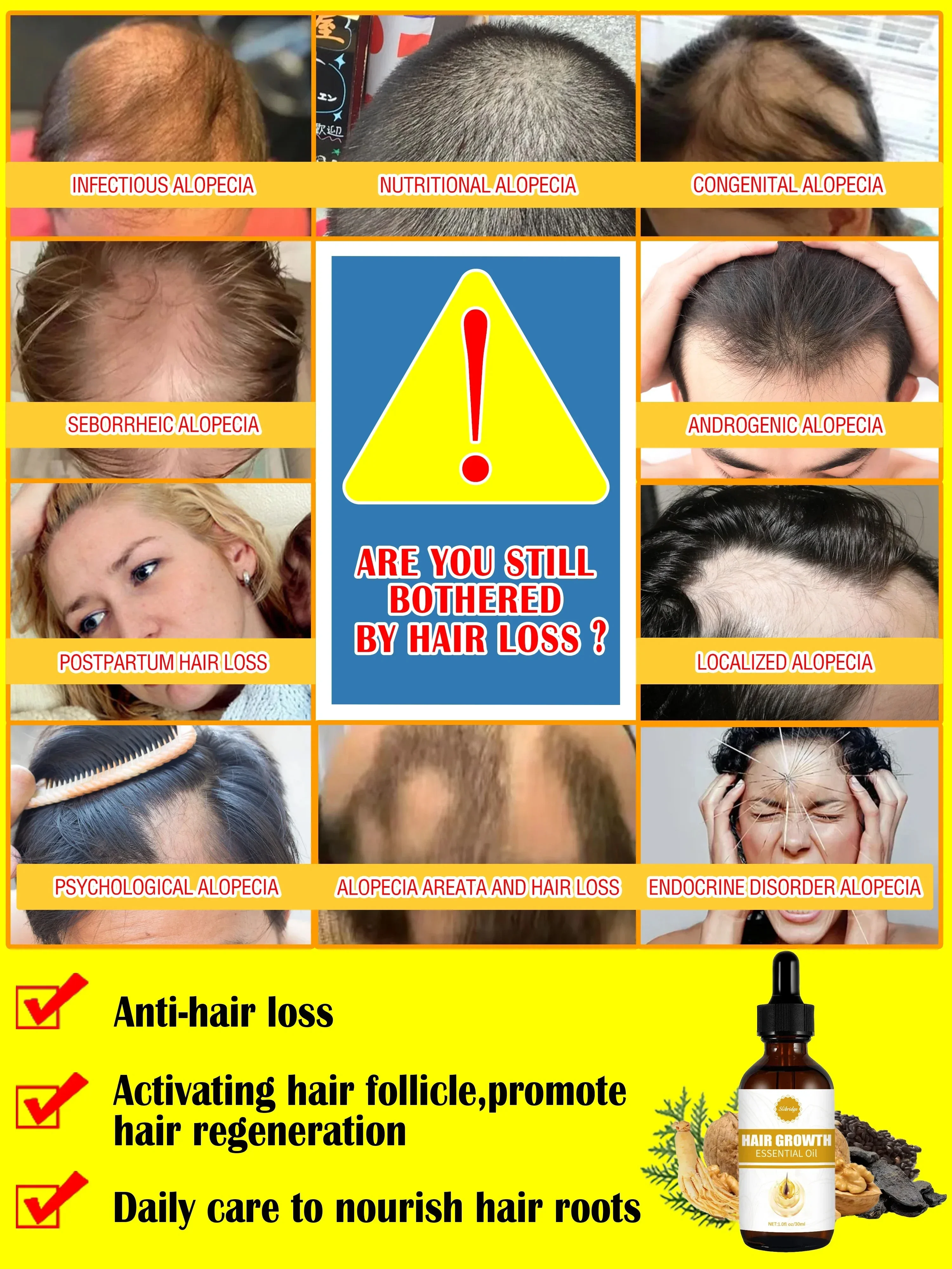 O óleo de crescimento capilar faz o cabelo crescer rapidamente, repara eficazmente uma calvície e uma queda de cabelo hereditária