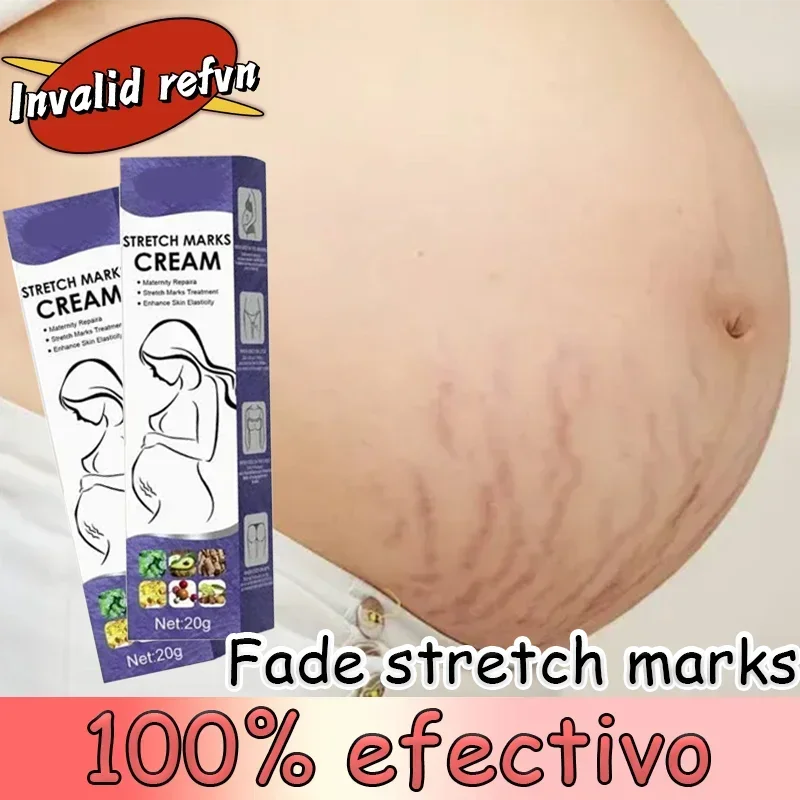 

Gentle Skin Care Improves Elasticity Effective After Pregnancy Stretch Marks Removal Powerful Maternity Cream Nourishes Skin