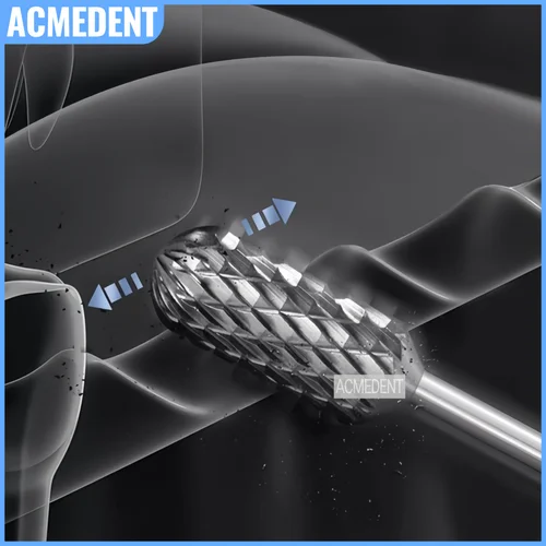 Imagen 2 del producto Taladro Dental de piña de 3 tamaños, taladro para recortar huesos, removedor de cresta, forma para esculpir, Contouring de cresta, fresas GBR