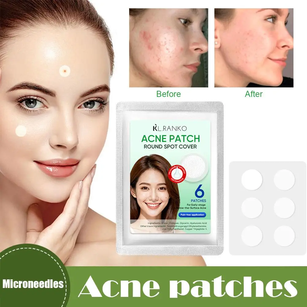 Microneedles Acne Patch Invisible Breathable Skin Care Removal Pimple Anti-Acne Repair Patchs Skin Care Tool Clean Pores Sterile