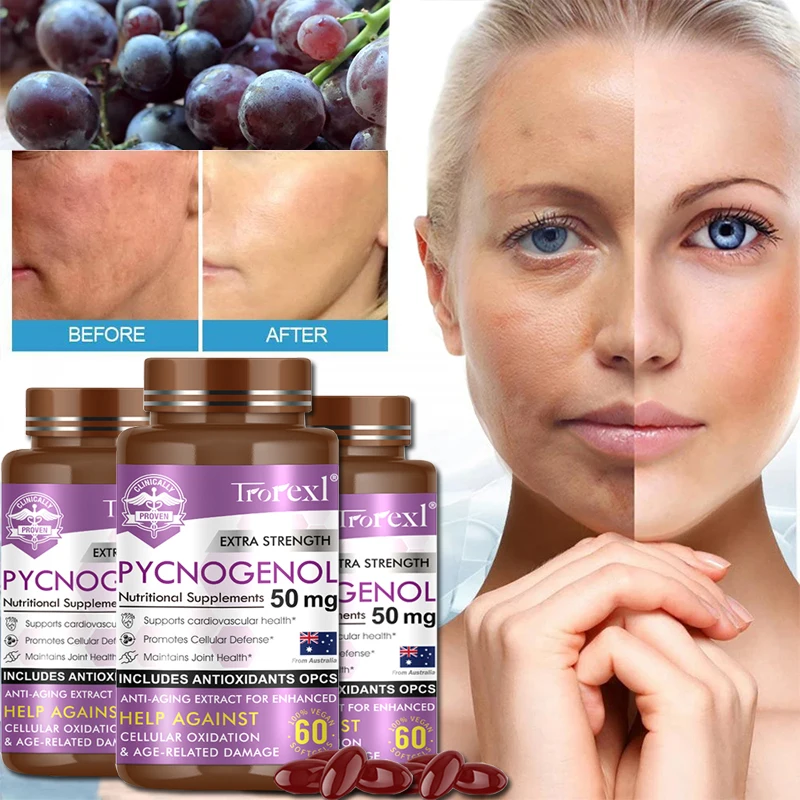 Anthocyanin Capsule Dark Spot Remover for Face, Melasma, Freckle, Sun Spot Remover&Blemish Reducer, Skin Care For All Skin Tones