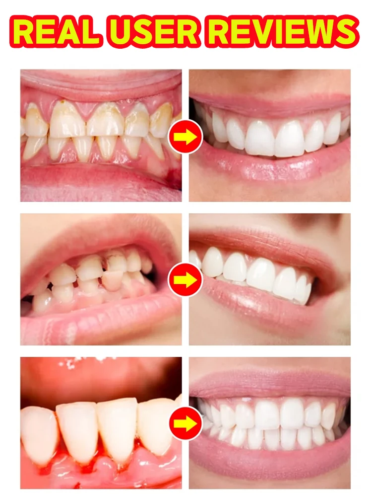 เอสเซนส์ป้องกันฟันผุ ฟื้นฟูเคลือบฟัน ซ่อมแซมฟัน เสริมสร้างความแข็งแรง ซ่อมแซมฟันผุ