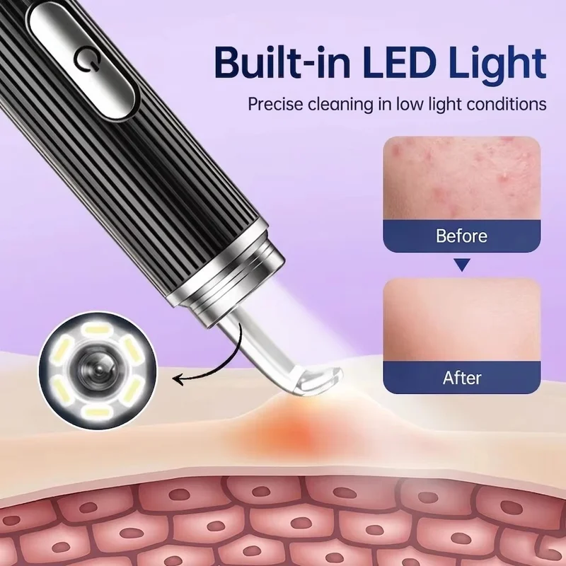 Visual Acne Cleaner 50x HD Camera Blackhead Pimples Remover Machine Electric Pore Cleaning Tools Face Beauty Device Skin Care