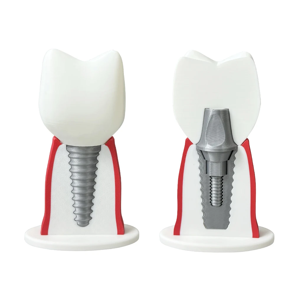 Thumbnail 4 - #2 Latest Dental Teaching Models Offers