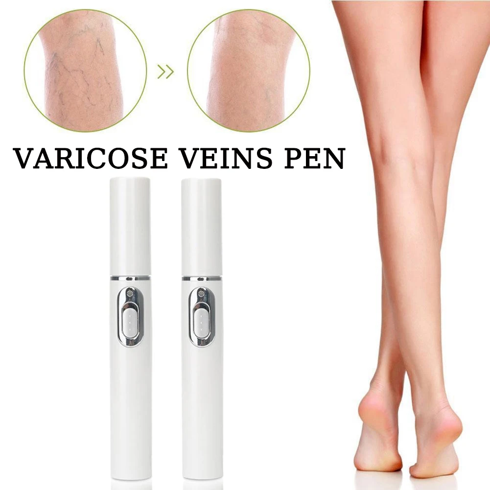 Terapia de luz azul tratamento de veias varicosas caneta laser tratamento flebite vasculite anti inchaço vaso sanguíneo bulge dor