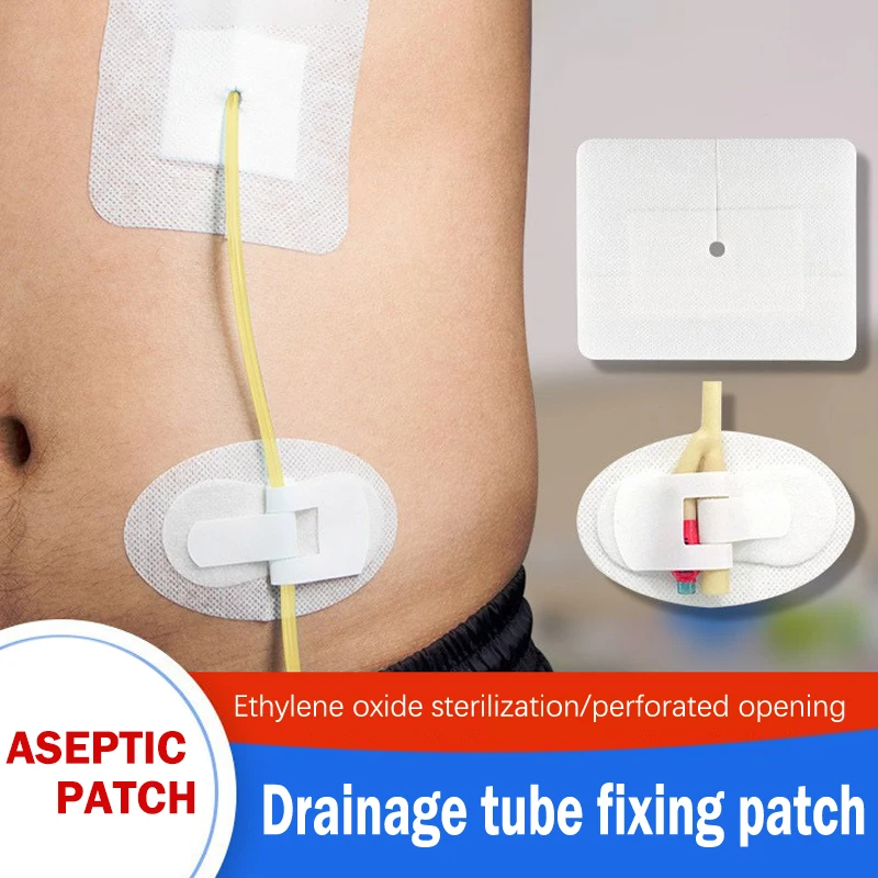 Drainage Tube Sterile Applicator Peritoneal Dialysis Catheter Bile Duct Nephrostomy Gastric Tube Drainage Fixed Sticker