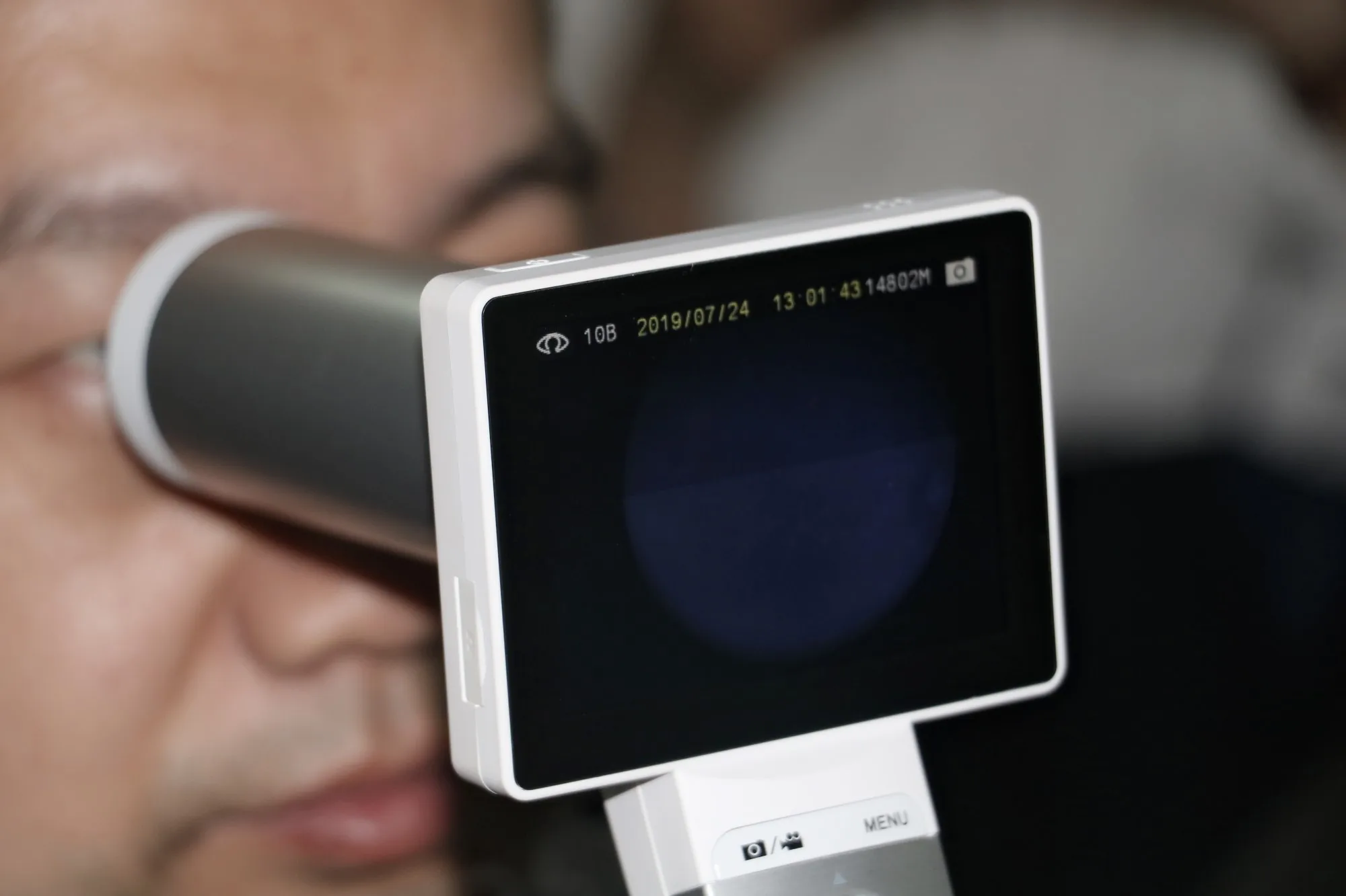 MiiS Fundus Camera Horus Caméra Fundus portable Caméra réinale