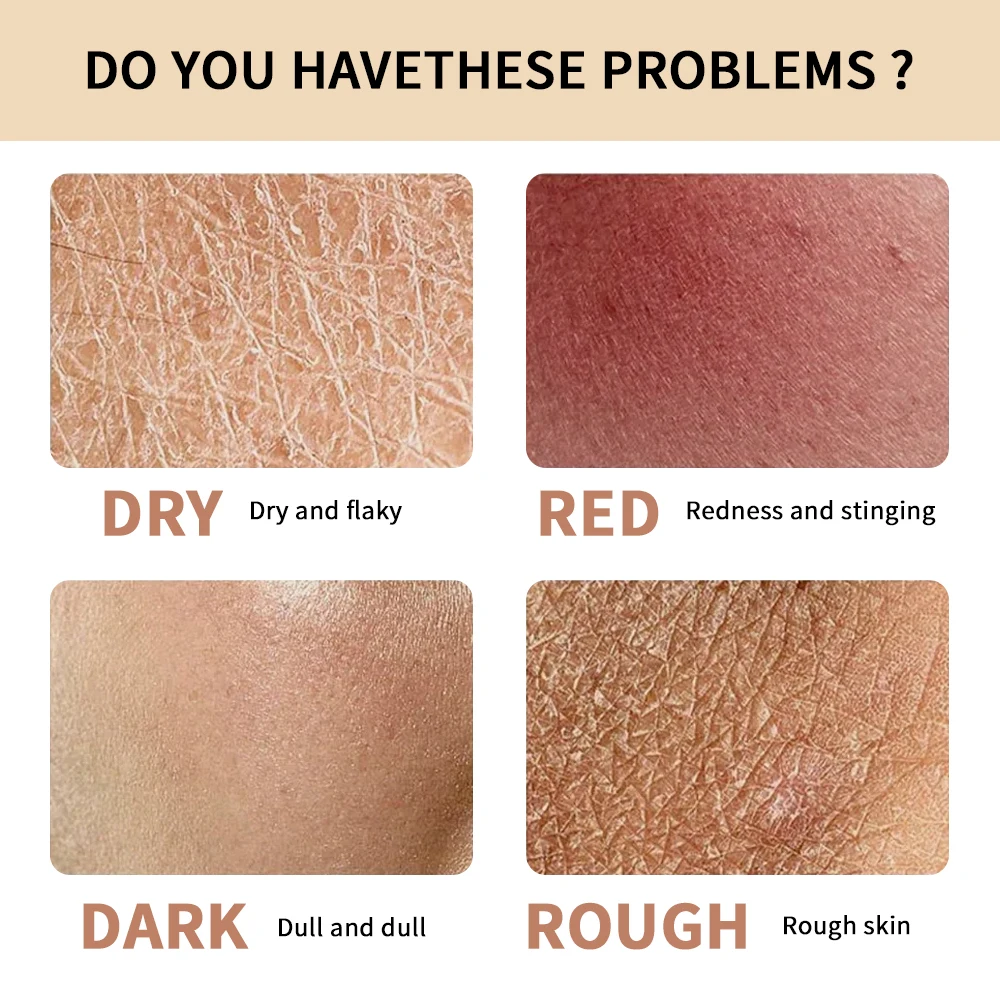 كريم ترطيب الوجه يدوم طويلاً، كريم العناية ببشرة الوجه المغذي العميق يقلل من منتجات المكياج ذات الخطوط الدقيقة