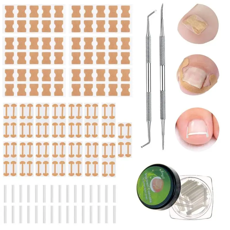 1 Set Adhesive Toenail Patch Ingrown Toe Nail Correction Sticker Foot Corrector Pedicure Healthcare Tools Toe Treatment Pad