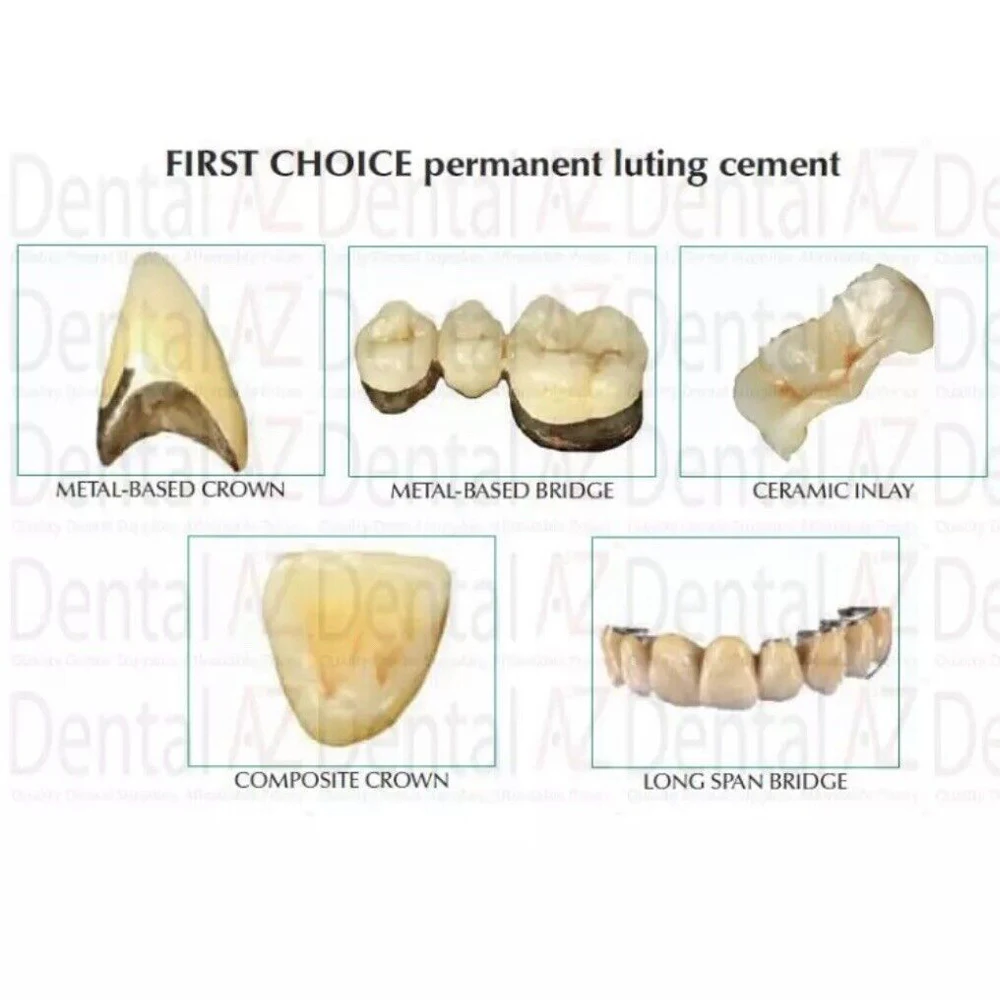 Permanent Dental Zement Kit für Zähne Crown Bridge Gic Fuji Super extra starker Klebstoff für Zahnersatz Zahnmedizin Material