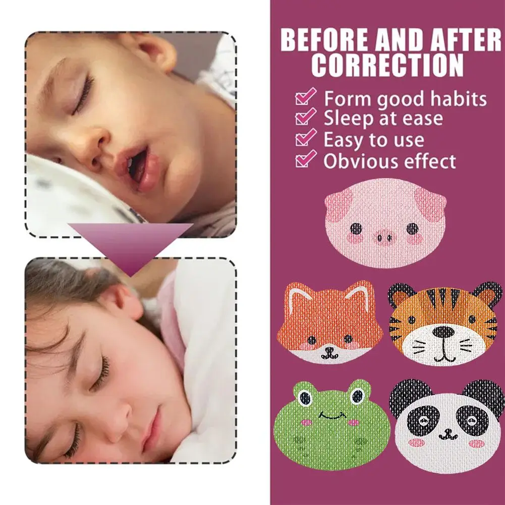 30Pcs Cartoon Anti-Snoring Stickers For Children Night Sleep Lip Nose Breathing Improving Patch Mouth Correction Sticker Tape