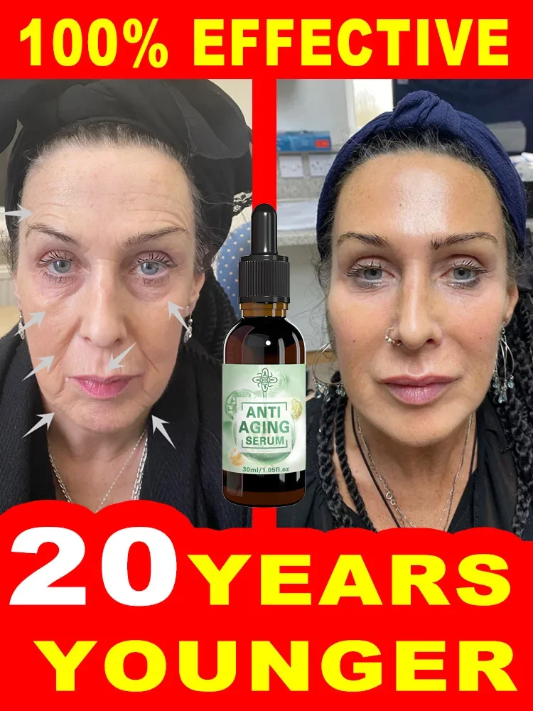 

wrinkles disappear become beautiful now