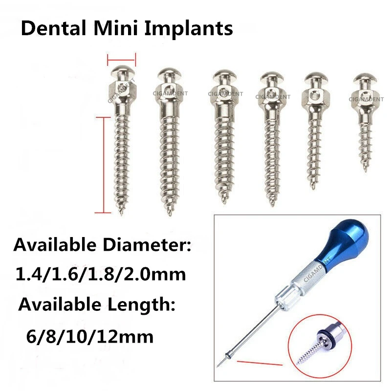 Dental Mini Micro Screws Titanium Alloy Screwdriver Wrench Self-Drilling 1.4/1.6/1.8/2.0mm