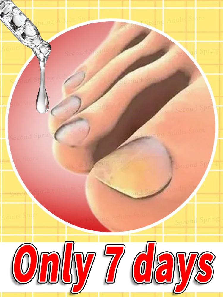 

2025 Toenail Pedicure Tool Fungus Prevention Technology Fungal Nail Patch, Extra Strength Nighttime Nail Repair for Damaged Disc
