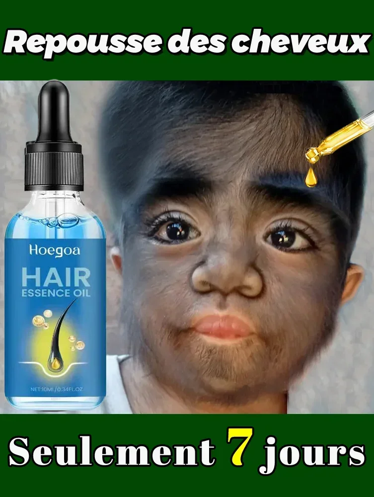 

SF52 Generation of Hair Care Oil,Prevents and Promotes Hair Growth Repair Drying Bifurcation Relieve Hair Loss