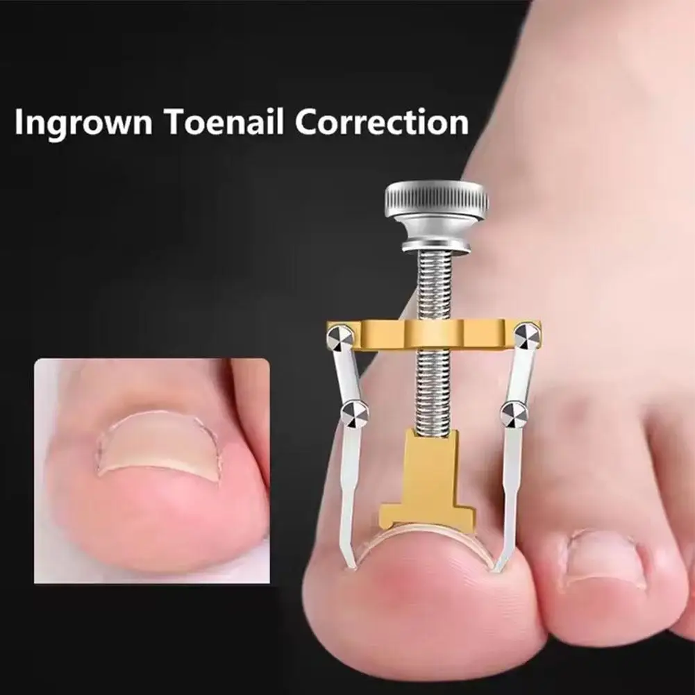 Nail Art Correction Tool Ingrown Toenail Corrector Nail Straighten Clip Ingrown Toenail Lifter Paronychia Corrector Foot Care