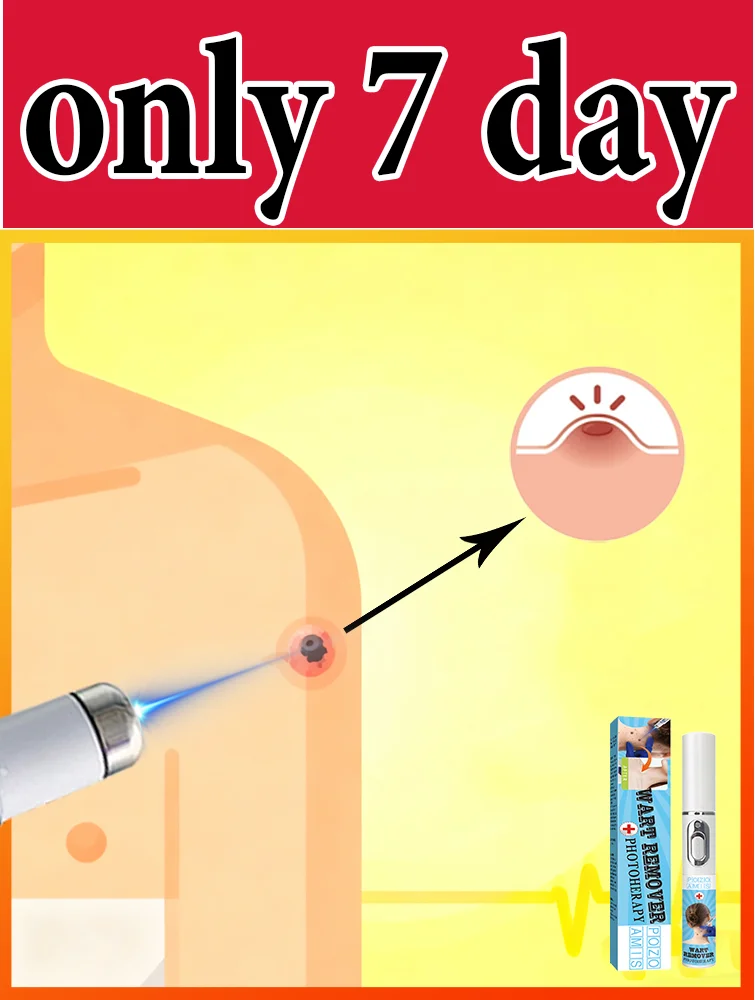 

Gᴇɴᴇʀᴀᴛɪᴏɴ-3 Lᴀsᴇʀ Sᴀʏs Gᴏᴏᴅʙʏᴇ Tᴏ Wᴀʀᴛs Iɴ 7 Dᴀʏs