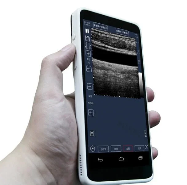 Handheld ultrasound machine linear mini portable ultrasound device ultrasound machine for smartphone