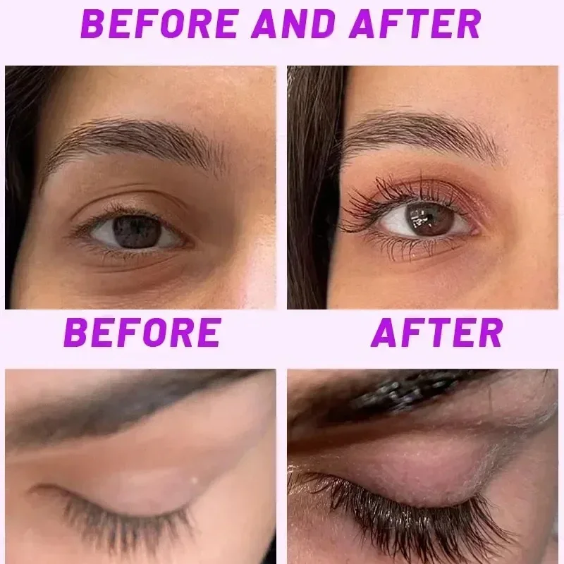 Wimperversterker Behandeling Wimper Groei Serum Dikkere Wimpers Natuurlijke Curling Lash Tillen Krachtige Verlengende Wimper