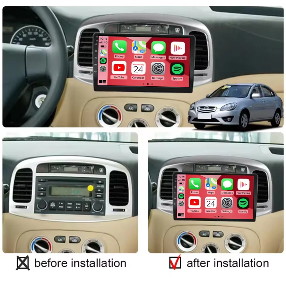 Android 14 Carplay Car Radio For Hyundai Accent 2006 2007 2008-2011 Navigation GPS Multimedia Player Stereo WiFi+4G Auto BT DSP