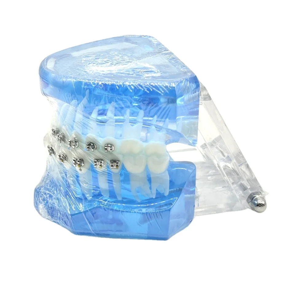 Рисунок 2 - Модель зубных протезов Полуметаллический