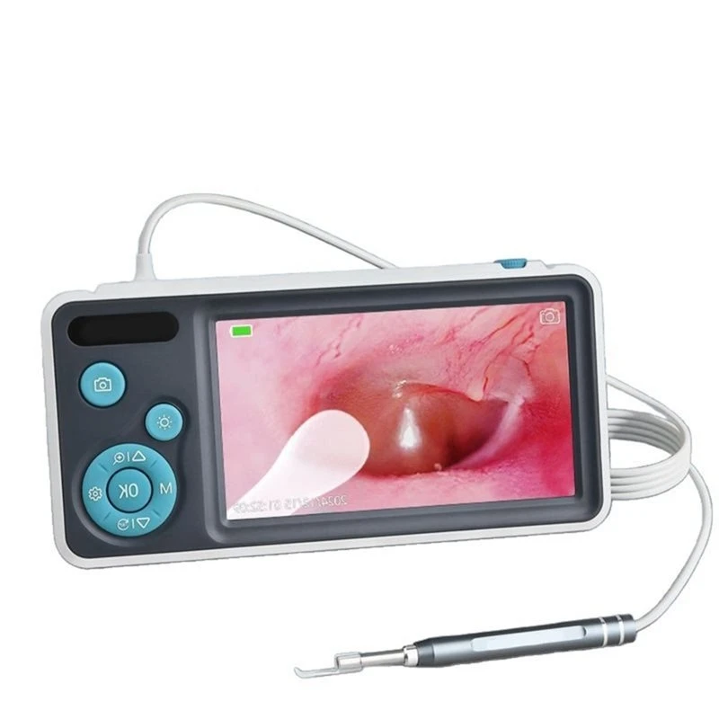 Smart Portable Digital Ear Camera Otoscope With IPS Screen 1080P For Kid Home Inspection Ear Cleaning Tool Cleaner