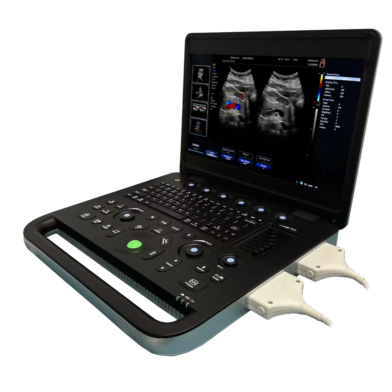 15.6 Inch Portable Color Doppler Ultrasound Machine Electric Power Laptop Ultrasound Scan Equipment For Animals For Pets For Vet