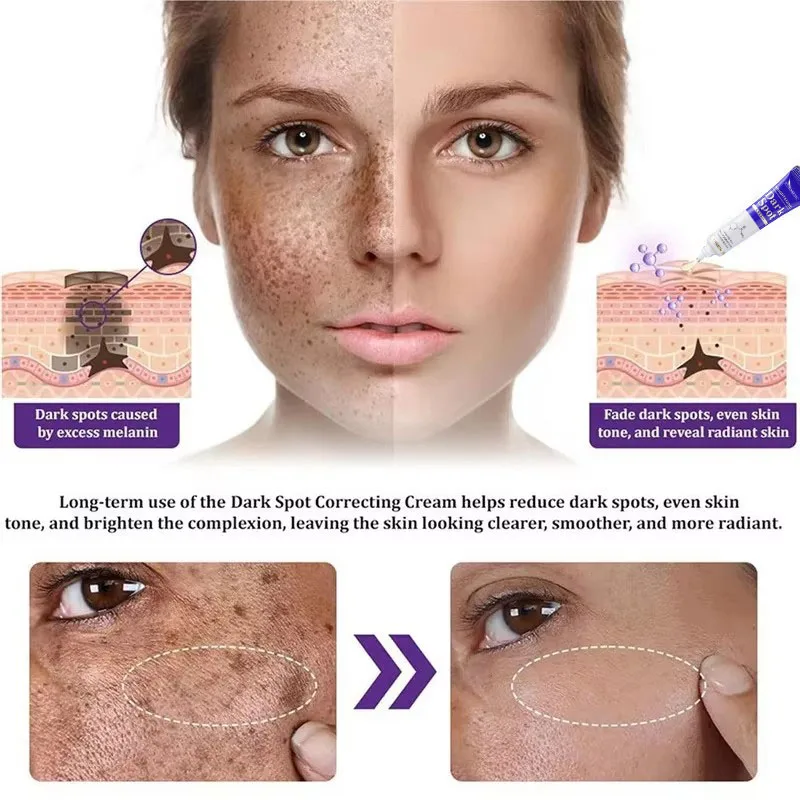Crema schiarente per macchie Niacinamide Riduce cloasma Melasma Melanina Dissolvenza Linee sottili Dissolvenza Macchia scura Opaco Idratante Cura del viso