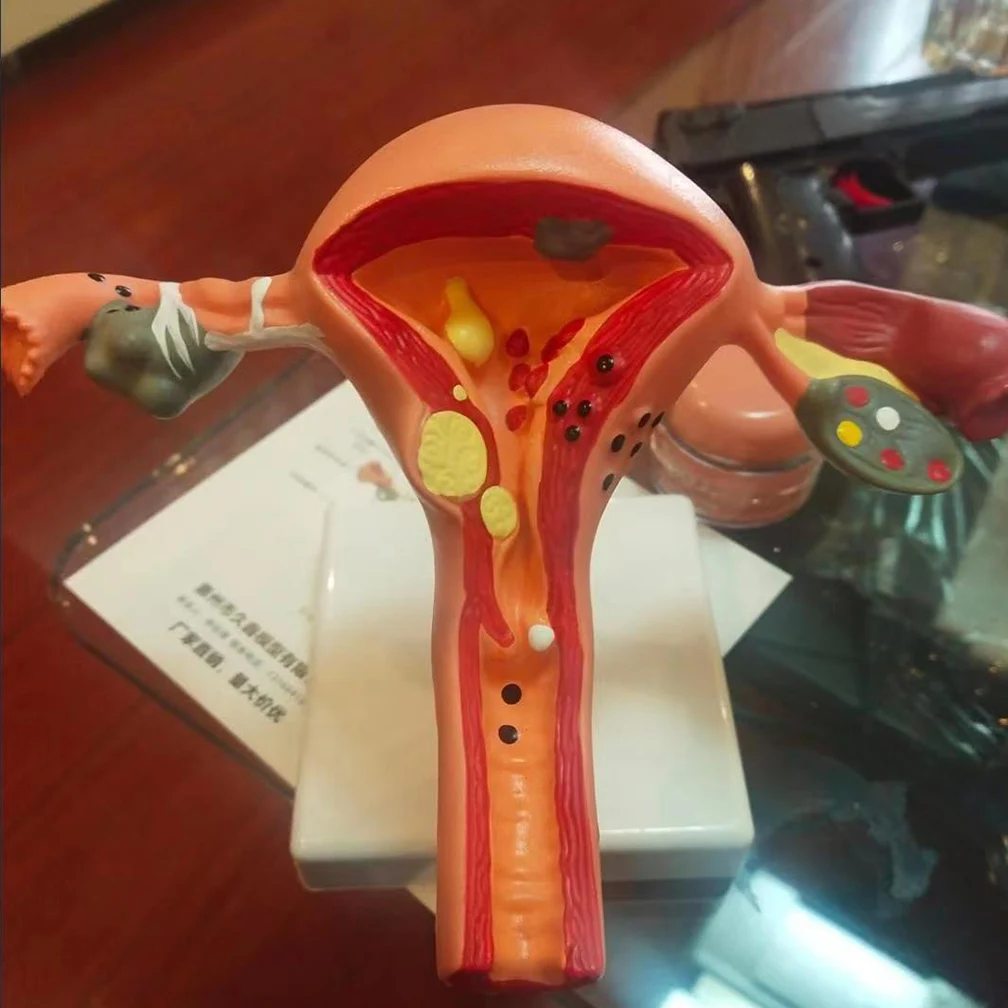 Cross Section Structure Model Human Pathological Uterus Ovary Model Uterus Anatomical Anatomy Female Organ Teaching Study Tool