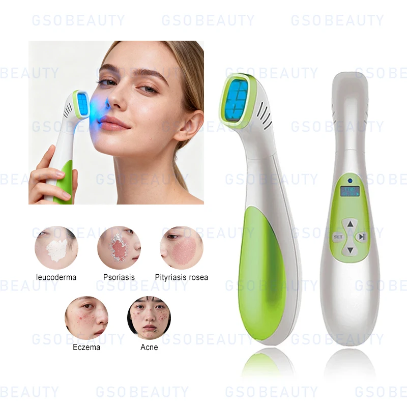 Best Selling 311Nm Narrow Band Uv Portable Therapy Handheld Phototherapy Device Low Level Laser Therapy - view 5