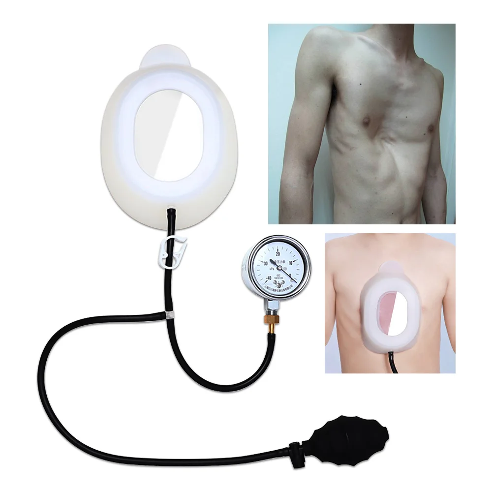 

Pectus Excavatum Orthosis Brace Sternal Depression Thoracic Sunken Sternum Support Funnel Chest Orthopedic for Adults Children