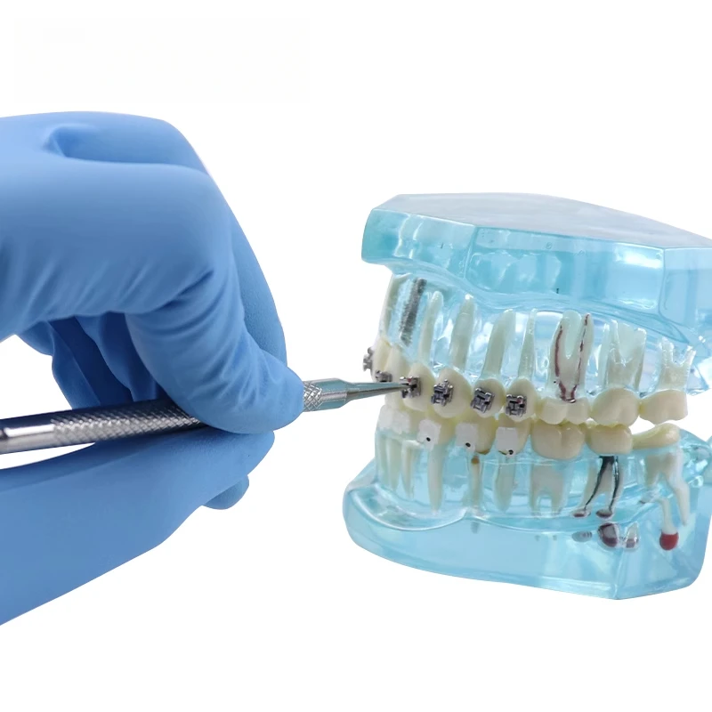 Dental Stainless Steel Bracket Tool Double Head Orthodontic Self-locking Bracket Lock Opener Oral Care Accessories