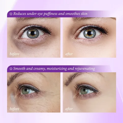 Imagen 2 del producto Crema de eliminación instantánea de bolsas de ojos, Retinol, antiarrugas, reafirmante, decoloración de la piel, líneas finas, anticírculo oscuro, hinchazón, ilumina el cuidado de la piel de los ojos