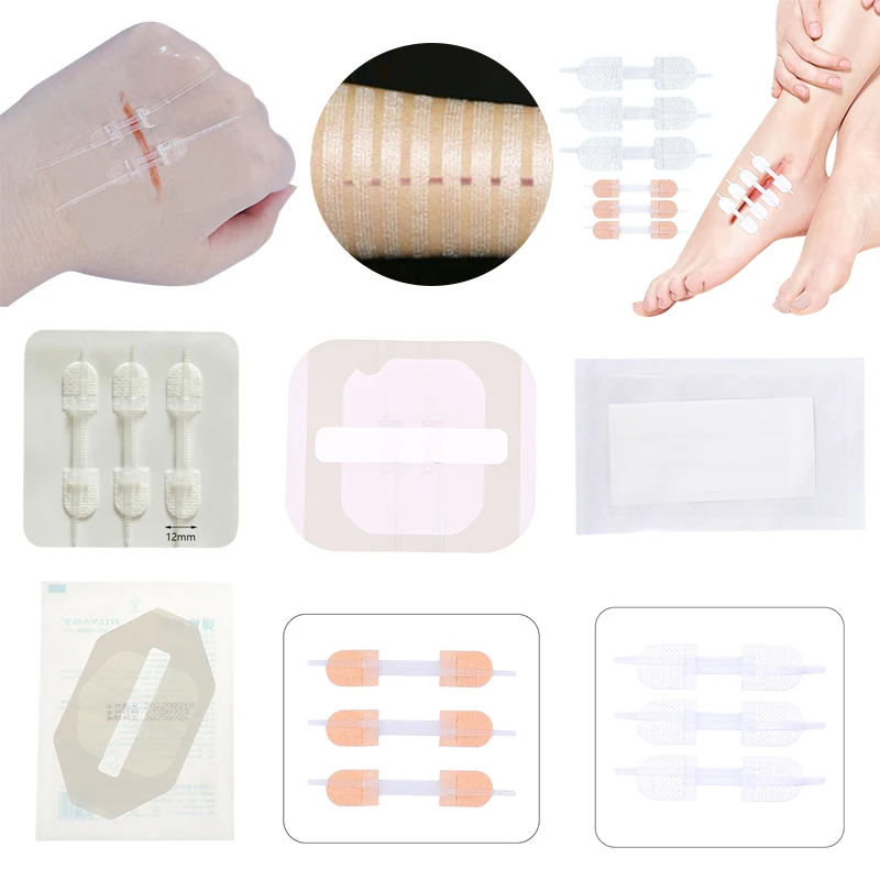 Zipper Tie Wound Encerramento Band-Aid, remendo hemostático, sutura rápida, portátil, ao ar livre, 2pcs, 3pcs