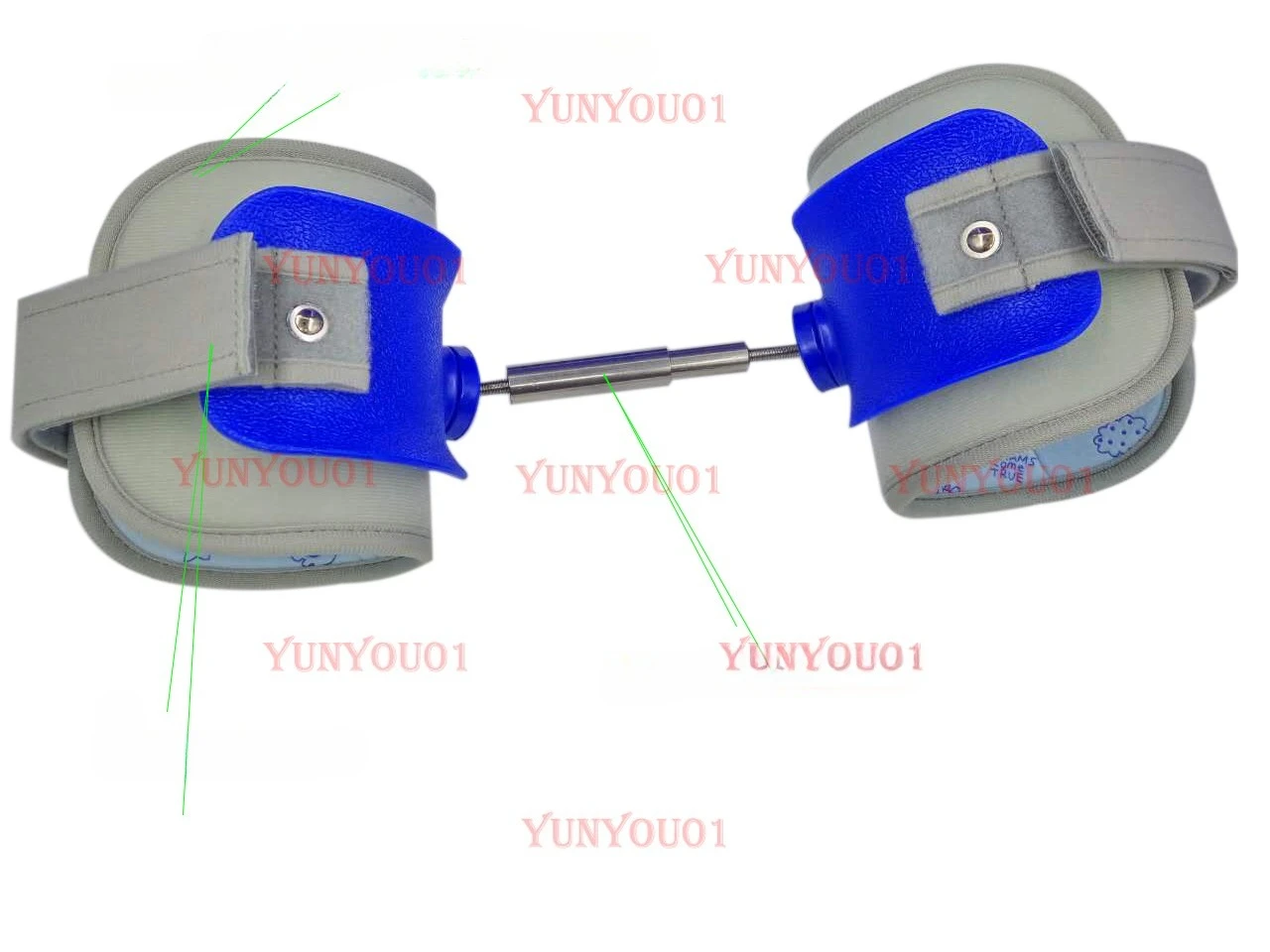 Pediatric Hip Dysplasia Orthosis, Hip Abductor, Scissor Step Controller, Hip Dislocation Fixator