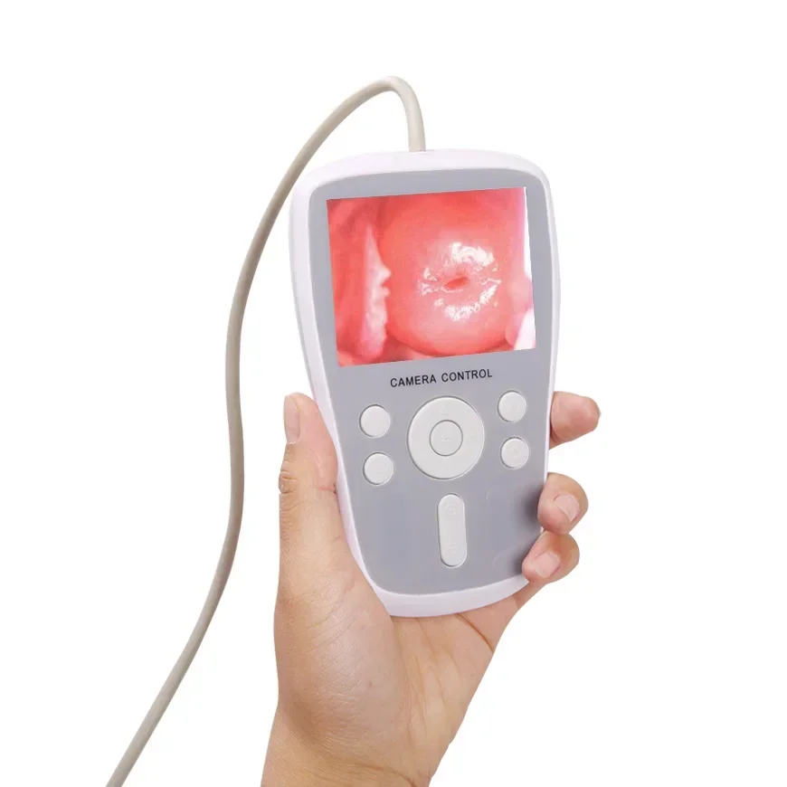 For HKN-2000 Handheld Digital Video Colposcope for Gynecology